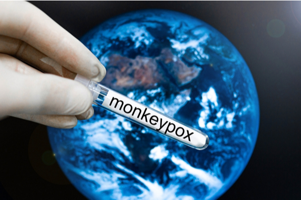 monkeypox